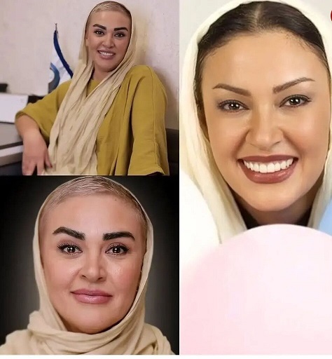 چهره باورنکردنی زیبا بروفه بعد از ۲۵سال+ عکس