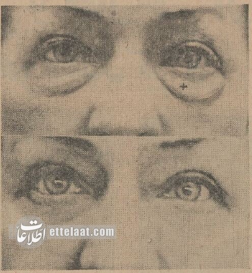 اولین جراحی&zwnj;های زیبایی در تهران اینجا انجام شد!&nbsp;+عکس و جزئیات