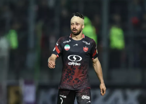 تصاویر؛ وضعیت سروش رفیعی بعد از بخیه ابرو