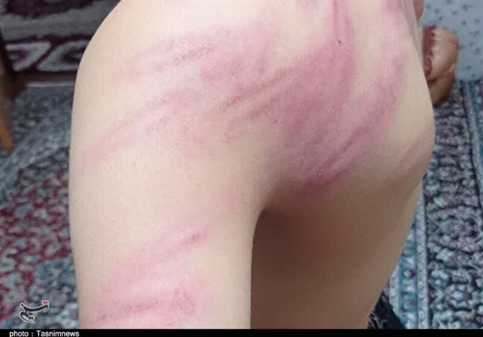 شکنجه‌ ۱۳ دانش‌آموز توسط معلم به ‌دلیل گم‌شدن شارژر