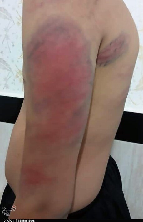 شکنجه‌ ۱۳ دانش‌آموز توسط معلم به ‌دلیل گم‌شدن شارژر