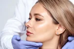 cheek-lift-cosmetic-surgery-3