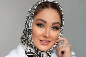 عکسی رو شده از چهره باورنکردنی الهام حمیدی قبل از عمل زیبایی