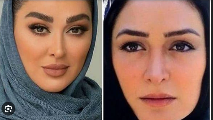 عکسی رو شده از چهره باورنکردنی الهام حمیدی قبل از عمل زیبایی