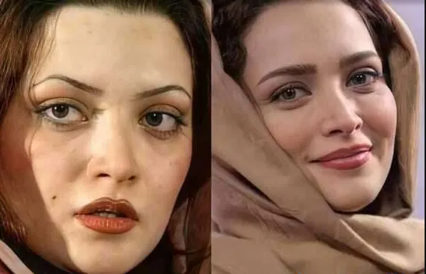 واقعا بهنوش طباطبایی قبل بازیگری این شکلی بود+ عکس