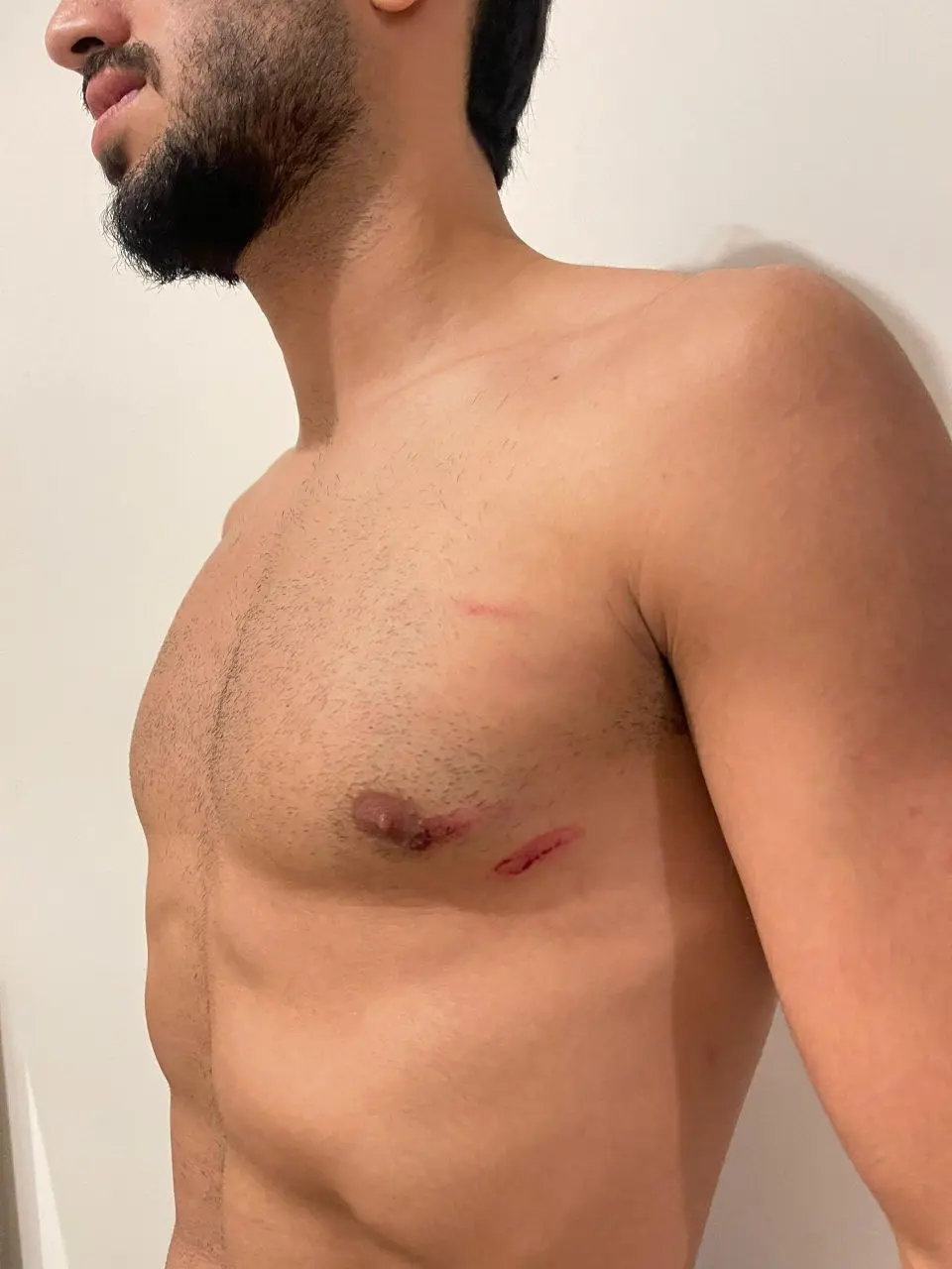 آسیبدیدگی محمد شریفی در برخورد شدید با سروش رفیعی آسیبدیدگی محمد شریفی در برخورد شدید با سروش رفیعی