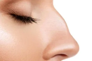 قوز بینی، ترند زیبایی سال ۲۰۲۶