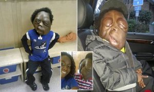 فیلم/ پسری که با عجیبترین صورت دنیا زندگی میکند!