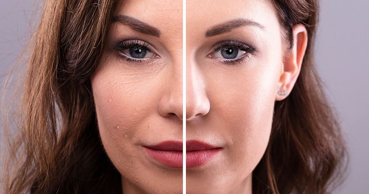 یوگای صورت میتواند چهره شما را چندین سال جوانتر کند!