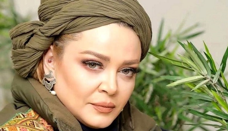 بلایی که “بهاره رهنما” با جراحی بر سر چهره اش آورد/ عکس