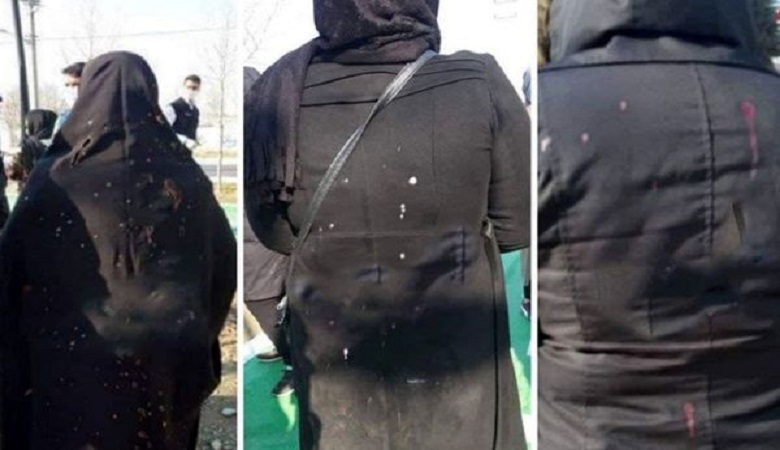 فاجعه هولناک اسیدپاشی به زن ها در پارک شهریار