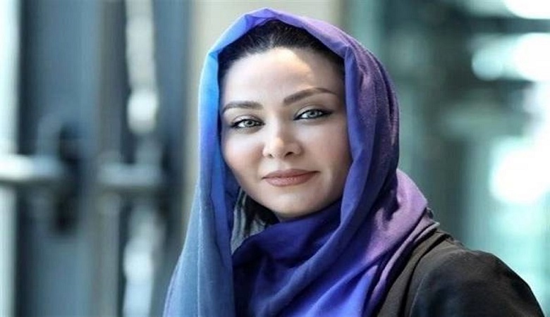 آرایش زیاد “خانم بازیگر” با صورت پر از مو/ تصویر