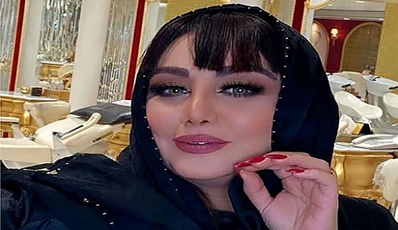 “بازیگر جنجالی” رکورددار عمل زیبایی در ایران شد/ عکس