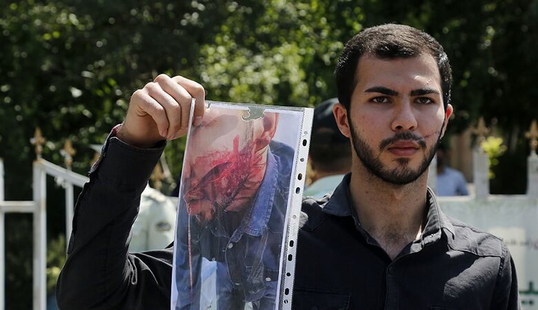 ویدئو/ حرفهای تلخ پسر جوانی که صورتش با زورگیری شکافته شد