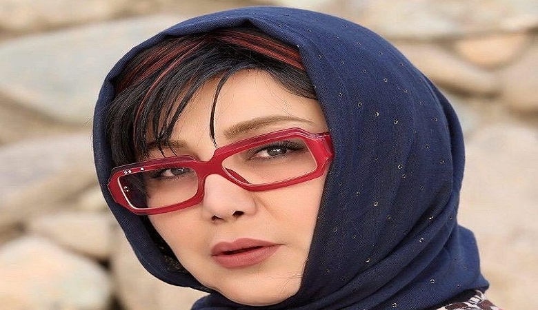 بلایی که “بهنوش بختیاری” بر سر چهره اش آورد/ عکس
