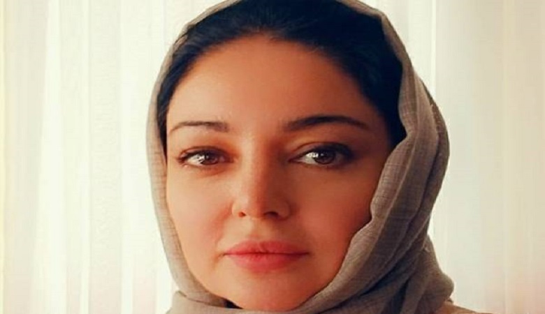 عمل زیبایی روی چهره “خانم بازیگر” حسابی جواب داد/ عکس