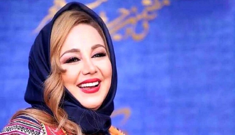 عکس/ بهنوش بختیاری مرزهای پیرسینگ چهره را رد کرد!