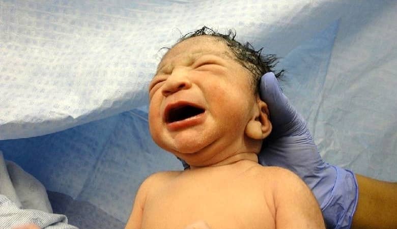 جدیدترین وضعیت نوزاد رها شده در سطل زباله