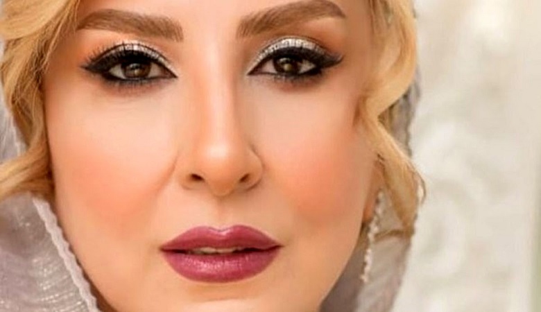 “مرجانه گلچین” 20 سال جوان تر شد/ عکس