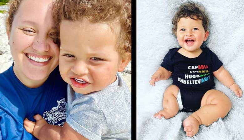 تصاویر/ تولد نوزادی خارق العاده که همه را متحیر کرد!