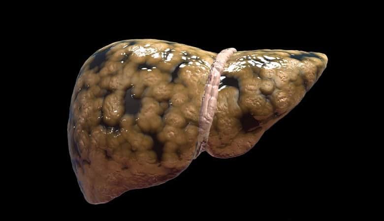 این چیزها کبد را نابود خواهند کرد