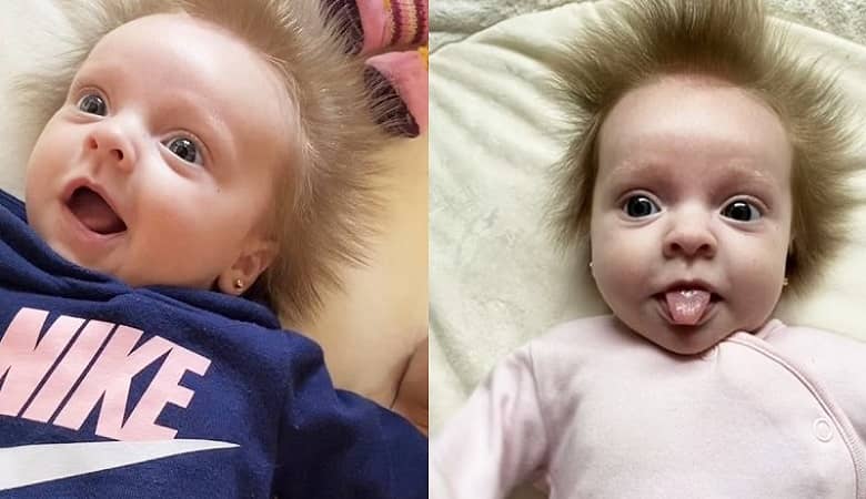 تصاویر/ موهای عجیب این نوزاد کل دنیا را حیرت زده کرد!