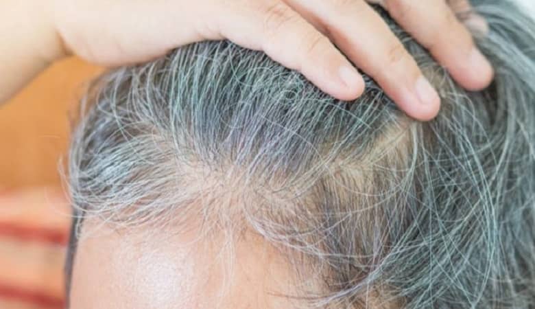 با چند کار ساده از شر موهای سفید راحت شوید!