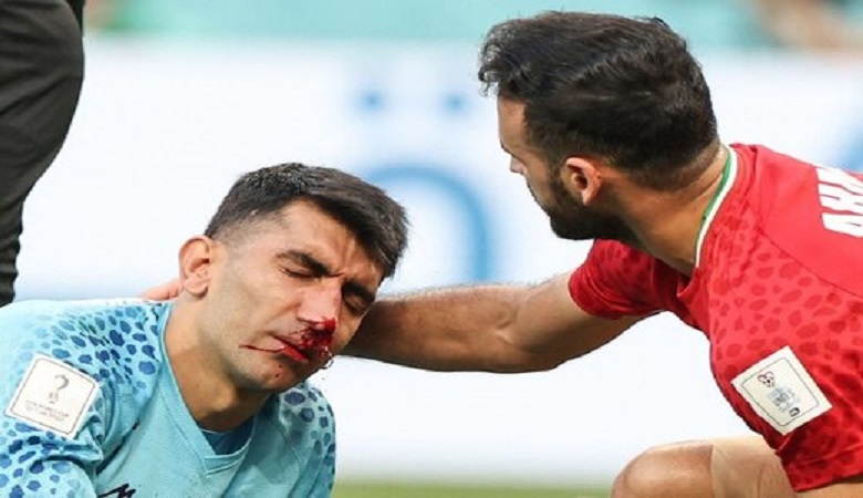 احتمال ضربه مغزی بیرانوند!