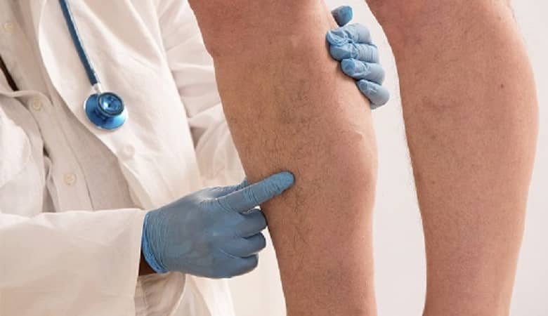 یک بیماری نگران کننده که منجر به قطع عضو و مرگ می شود!