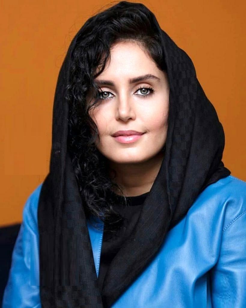 عمل زیبایی چهره “الناز شاکردوست” را عوض کرد/ عکس