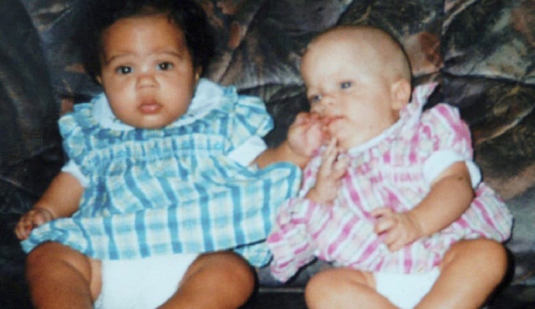 تصاویر/ عجیبترین دوقلوهایی که تاکنون متولد شده اند!