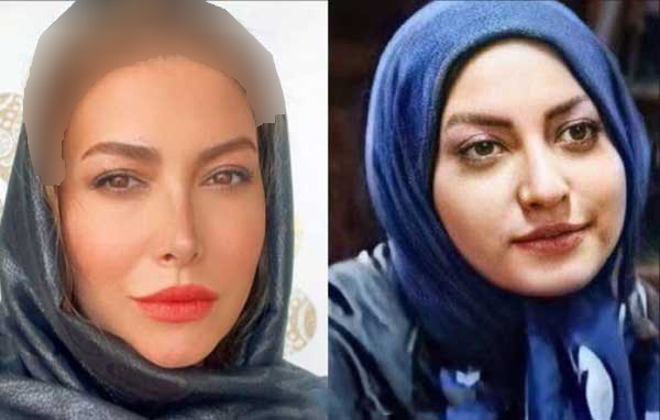 قطعا چهره “این خانم بازیگر ایرانی” را قبل عمل های زیبایی نمی شناسید/ عکس