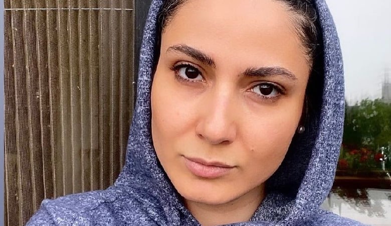 عکس/ گربه‌ای که نزدیک بود خانم بازیگر را بی‌حجاب کند!