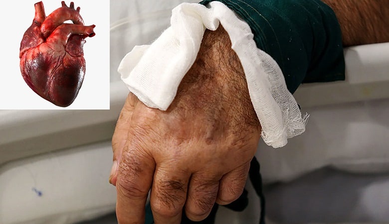 واقعی/ ماجرای تکان دهنده پسر مشهدی که قلب پدرش را خورد!