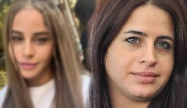 تغییرات زمین تا آسمان خانم بازیگر با جراحی‌های زیبایی!