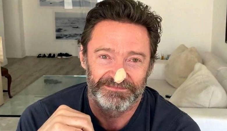 بازیگر خوش نام سینما به بیماری سخت مبتلا شد!