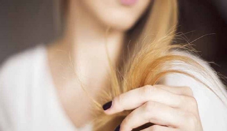 راههای کم هزینه و آسان برای درمان موخوره