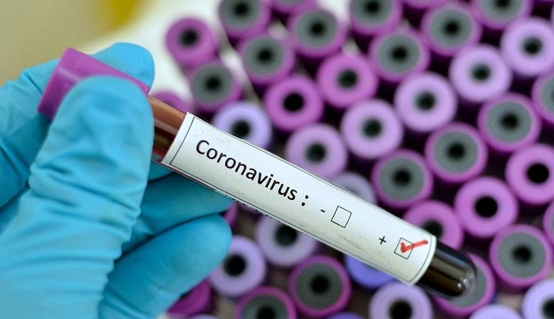 کاش دنیا جهانبخت این عکس آرتام را منتشر نمی کرد+ تصویر