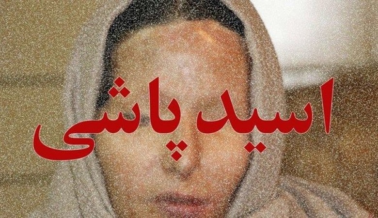 اسیدپاشی این بار در تهران