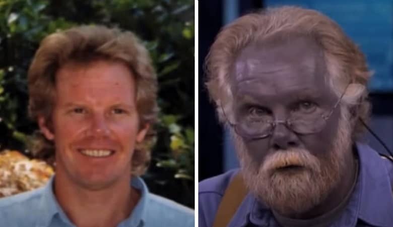 رنگ عجیب پوست این مرد، جهان را متحیر کرد!+عکس