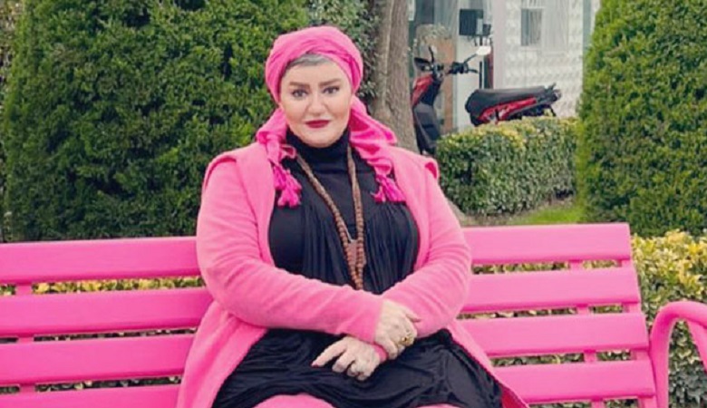 جراحی زیبایی از خانم بازیگر چهره دیگری ساخت+عکس