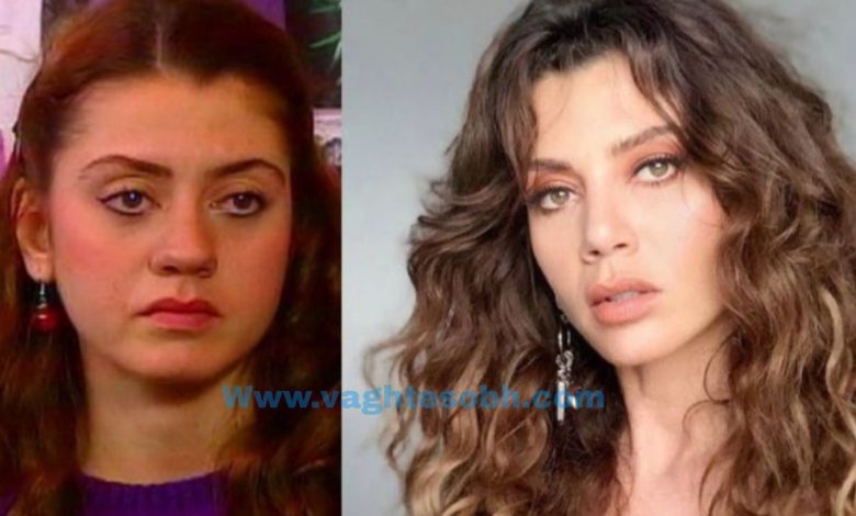 چهره باورنکردنی خانم بازیگر سریال برگریزان پس از عملهای زیبایی/ عکس