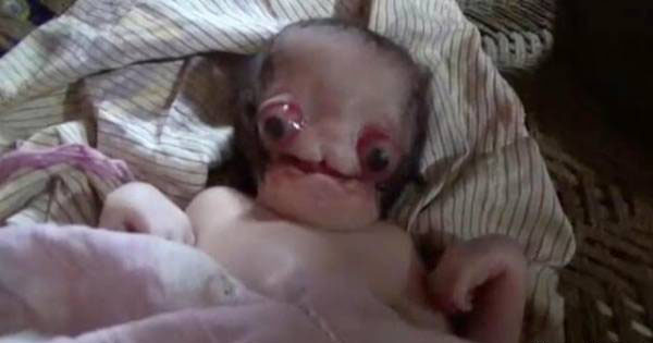 ترسناک ترین نوزاد عجیب الخلقه را دیده اید/ عکس