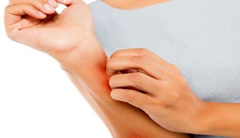 علائم هشداردهنده کبد که روی پوست ظاهر می شود