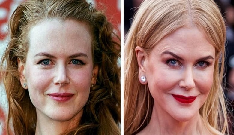 سلبریتی ها بدون عمل های زیبایی این شکلی بودند+عکس