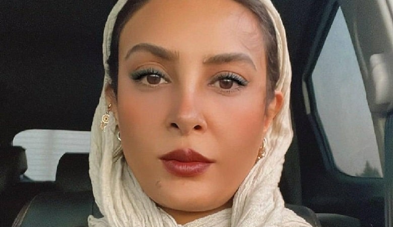 عکس/ خانم بازیگر نروژ گردیاش را سانسور کرد!