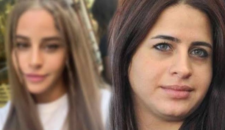 ببینید خانم بازیگر بعد از دهها جراحی زیبایی چه شکلی شده است!