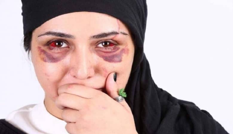 عکس/ صبا راد دوباره با چهره تازه ظاهر شد!