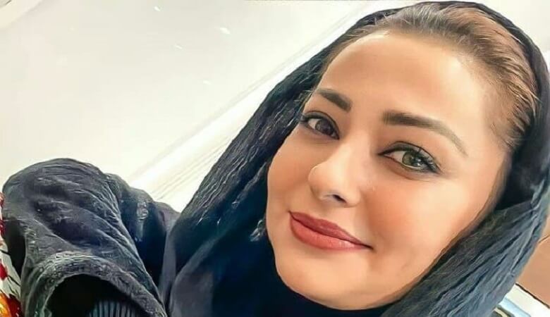 عکس/ آرایش غلیظ هم نتوانست جوش‌های صورت نفیسه روشن را بپوشاند