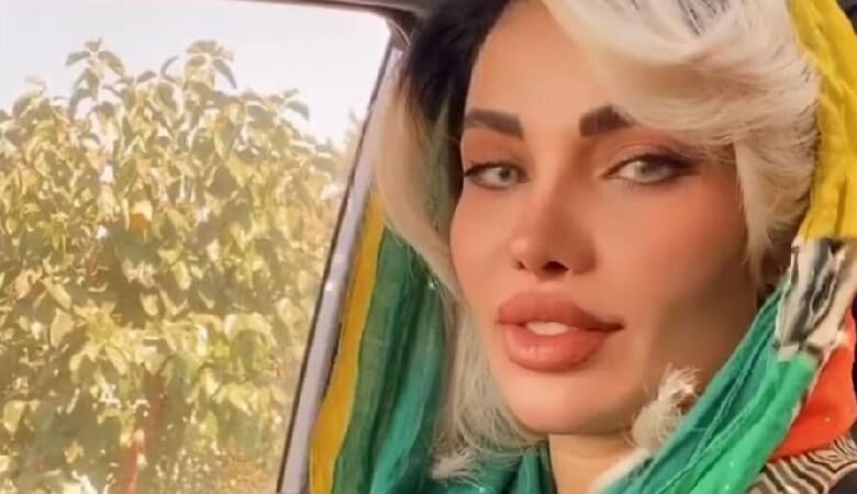عکس/ همسر مهدی قائدی قبل از عمل زیبایی!